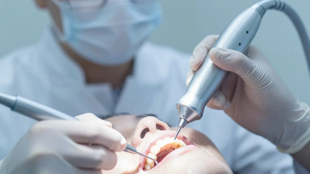 Ošetření zubního kamene pomocí ultrazvukového přístroje.